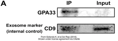 Anti-CD9 antibody [MEM-61] used in Western Blot (WB). GTX22215