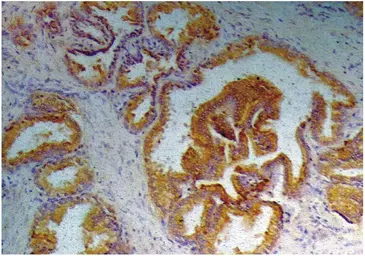 Anti-PSA antibody [A67-B/E3] used in IHC (Paraffin sections) (IHC-P). GTX22218