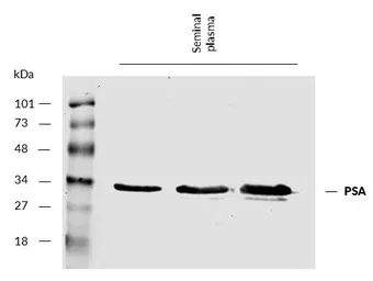 Anti-PSA antibody [A67-B/E3] used in Western Blot (WB). GTX22218