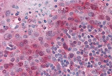 Anti-TMS1 antibody, C-term used in IHC (Paraffin sections) (IHC-P). GTX22236