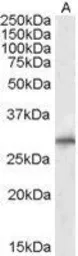 Anti-SIAH1 antibody used in Western Blot (WB). GTX22237