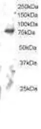 Anti-ELMO2 antibody used in Western Blot (WB). GTX22240