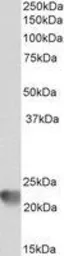 Anti-RAC2 antibody used in Western Blot (WB). GTX22244