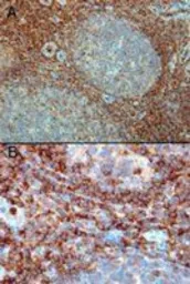 Anti-RAC2 antibody used in IHC (Paraffin sections) (IHC-P). GTX22244