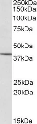 Anti-PSCDBP antibody, N-term used in Western Blot (WB). GTX22247