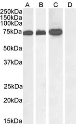 Anti-RACGAP1 antibody used in Western Blot (WB). GTX22270