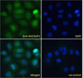Anti-RACGAP1 antibody used in Immunocytochemistry/ Immunofluorescence (ICC/IF). GTX22270