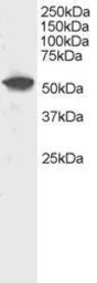 Anti-DUSP10 antibody used in Western Blot (WB). GTX22272