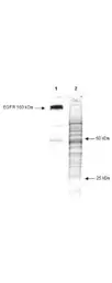 Anti-Phosphotyrosine antibody [13F9] used in Western Blot (WB). GTX22287
