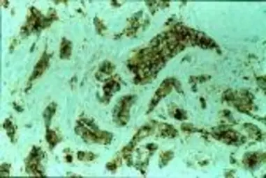 Anti-MVP/LRP antibody [1032] used in Immunohistochemistry (IHC). GTX22376