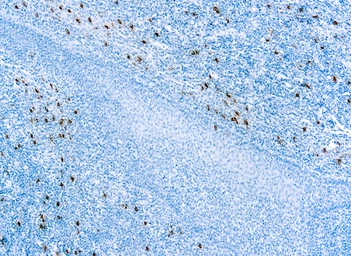 Anti-Mast cell tryptase antibody [AA1] used in IHC (Paraffin sections) (IHC-P). GTX22378