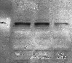 Anti-PAK1 ( phospho Thr423 ) / PAK2 ( phospho Thr402 ) / PAK3 ( phospho Thr436 ) antibody used in Western Blot (WB). GTX22477