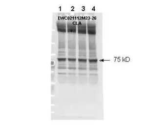 Anti-Merlin (phospho Ser518) antibody used in Western Blot (WB). GTX22478