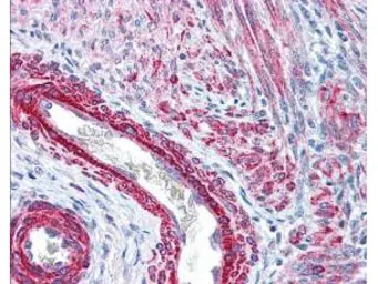 Anti-Myosin Light Chain 2 (phospho Ser19) antibody used in IHC (Paraffin sections) (IHC-P). GTX22480