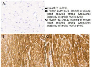 Anti-Myosin Light Chain 2 (phospho Ser19) antibody used in IHC (Paraffin sections) (IHC-P). GTX22480