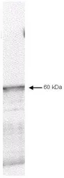 Anti-Pyruvate dehydrogenase kinase 1 / PDK1 antibody used in Western Blot (WB). GTX22495