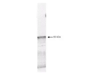 Anti-Pyruvate dehydrogenase kinase 1 / PDK1 antibody used in Western Blot (WB). GTX22495