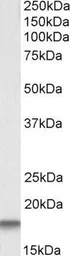 Anti-Cystatin C antibody, C-term used in Western Blot (WB). GTX22516
