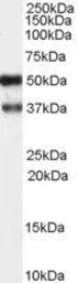 Anti-PACSIN1 antibody used in Western Blot (WB). GTX22532