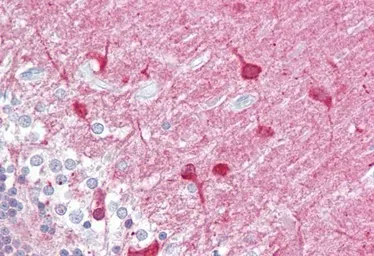 Anti-PACSIN1 antibody used in IHC (Paraffin sections) (IHC-P). GTX22532