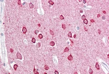 Anti-PACSIN1 antibody used in IHC (Paraffin sections) (IHC-P). GTX22532