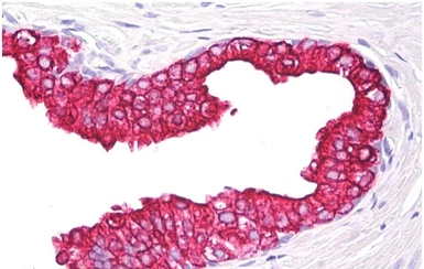 Anti-Cytokeratin 5 + 18 antibody [C-50] used in IHC (Paraffin sections) (IHC-P). GTX22535