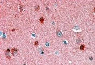 Anti-RKIP antibody, C-term used in IHC (Paraffin sections) (IHC-P). GTX22634