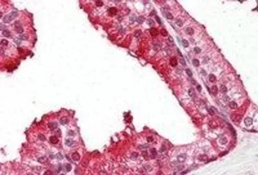 Anti-RKIP antibody, C-term used in IHC (Paraffin sections) (IHC-P). GTX22634