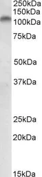 Anti-PLK4 antibody, N-term used in Western Blot (WB). GTX22642