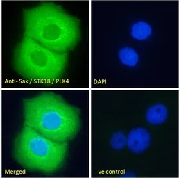 Anti-PLK4 antibody, N-term used in Immunocytochemistry/ Immunofluorescence (ICC/IF). GTX22642