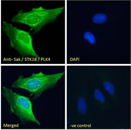 Anti-PLK4 antibody, N-term used in Immunocytochemistry/ Immunofluorescence (ICC/IF). GTX22642