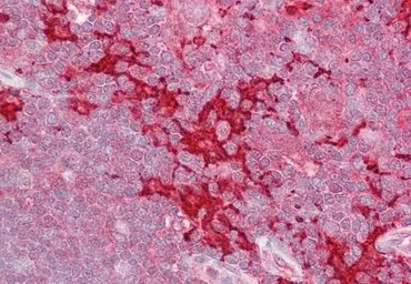 Anti-MAP4K1 antibody, N-term used in IHC (Paraffin sections) (IHC-P). GTX22646