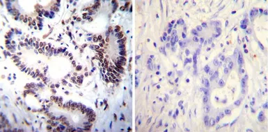 Anti-NFAT1 antibody [25A10.D6.D2] used in IHC (Paraffin sections) (IHC-P). GTX22722