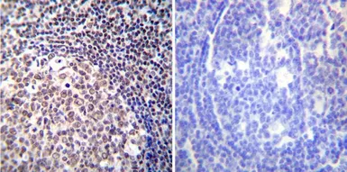 Anti-NFAT1 antibody [25A10.D6.D2] used in IHC (Paraffin sections) (IHC-P). GTX22722