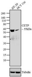 Anti-CETP antibody [ATM192] used in Western Blot (WB). GTX22726