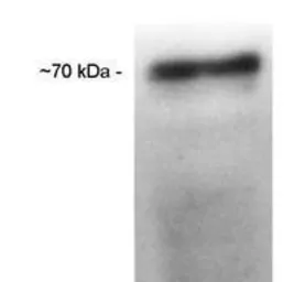 Anti-CETP antibody [ATM192] used in Western Blot (WB). GTX22726