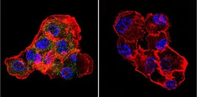 Anti-CETP antibody [ATM192] used in Immunocytochemistry/ Immunofluorescence (ICC/IF). GTX22726