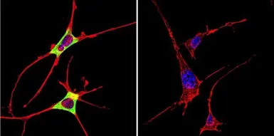 Anti-Cytohesin 2 antibody [10A12] used in Immunocytochemistry/ Immunofluorescence (ICC/IF). GTX22728