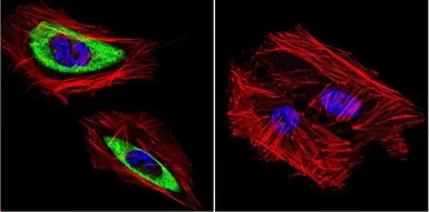 Anti-Cytohesin 2 antibody [10A12] used in Immunocytochemistry/ Immunofluorescence (ICC/IF). GTX22728