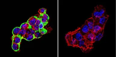 Anti-Cytohesin 2 antibody [10A12] used in Immunocytochemistry/ Immunofluorescence (ICC/IF). GTX22728