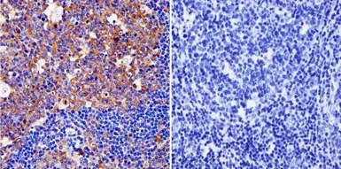 Anti-Cytohesin 1 + Cytohesin 2 antibody [6G11] used in IHC (Paraffin sections) (IHC-P). GTX22729