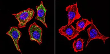 Anti-IGF2R antibody [2G11] used in Immunocytochemistry/ Immunofluorescence (ICC/IF). GTX22733
