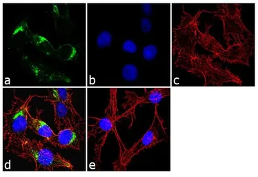 Anti-IGF2R antibody [2G11] used in Immunocytochemistry/ Immunofluorescence (ICC/IF). GTX22733