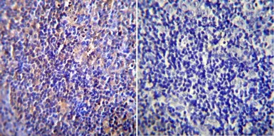 Anti-Nucleoporin p62 antibody [RL1] used in IHC (Paraffin sections) (IHC-P). GTX22734