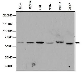 Anti-Nucleoporin p62 antibody [RL31] used in Western Blot (WB). GTX22736