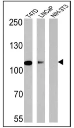 Anti-Androgen Receptor antibody [AN1-15] used in Western Blot (WB). GTX22742
