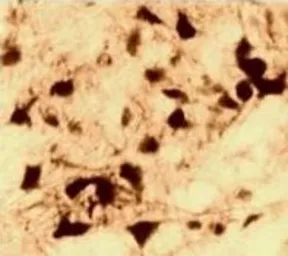 Anti-Androgen Receptor antibody [AN1-15] used in IHC (Paraffin sections) (IHC-P). GTX22742