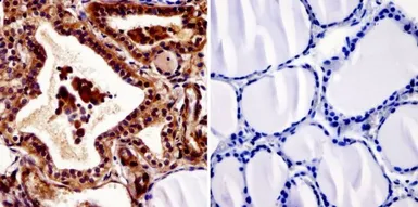 Anti-Thyroid Hormone Receptor antibody [C3] used in IHC (Paraffin sections) (IHC-P). GTX22743