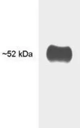 Anti-Thyroid Hormone Receptor antibody [C3] used in Western Blot (WB). GTX22743