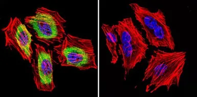 Anti-Thyroid Hormone Receptor antibody [C3] used in Immunocytochemistry/ Immunofluorescence (ICC/IF). GTX22743